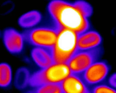 bacteria spores